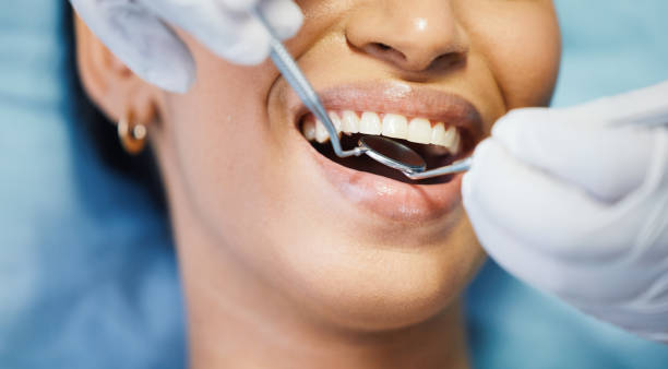 Best Emergency Root Canal Treatment in Brownstown, IN